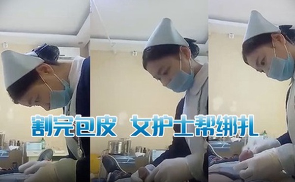 割完包皮女护士帮绑扎